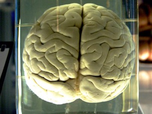 O novo método, Clarity, dá uma visão clara do cérebro Foto: Flickr/MidniteSonnet