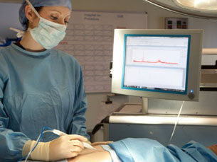 O iKnife demora cerca de três segundos a dizer ao cirurgião se o tecido que está a cortar é ou não cancerígeno Foto: Imperial College London,