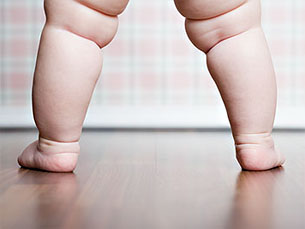 Estudo alerta para a diminuição da idade das crianças que recorrem a consultas de obesidade Foto: Seridec