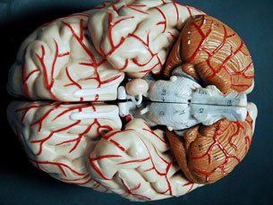 Comparar cortes de tecido cerebral permite perceber quais as zonas mais atrofiadas em cada doença Foto: djneight/Flickr