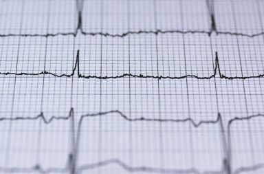 O electrocardiograma foi uma das formas de diagnóstico reconhecidas pelos portugueses inquiridos.